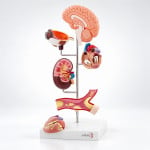 Hypertension Model 6 Parts